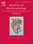 Atypical Wenckebach without grouped beating due to dual AV nodal conduction