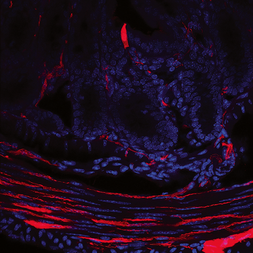 RET signalling controls gut motility