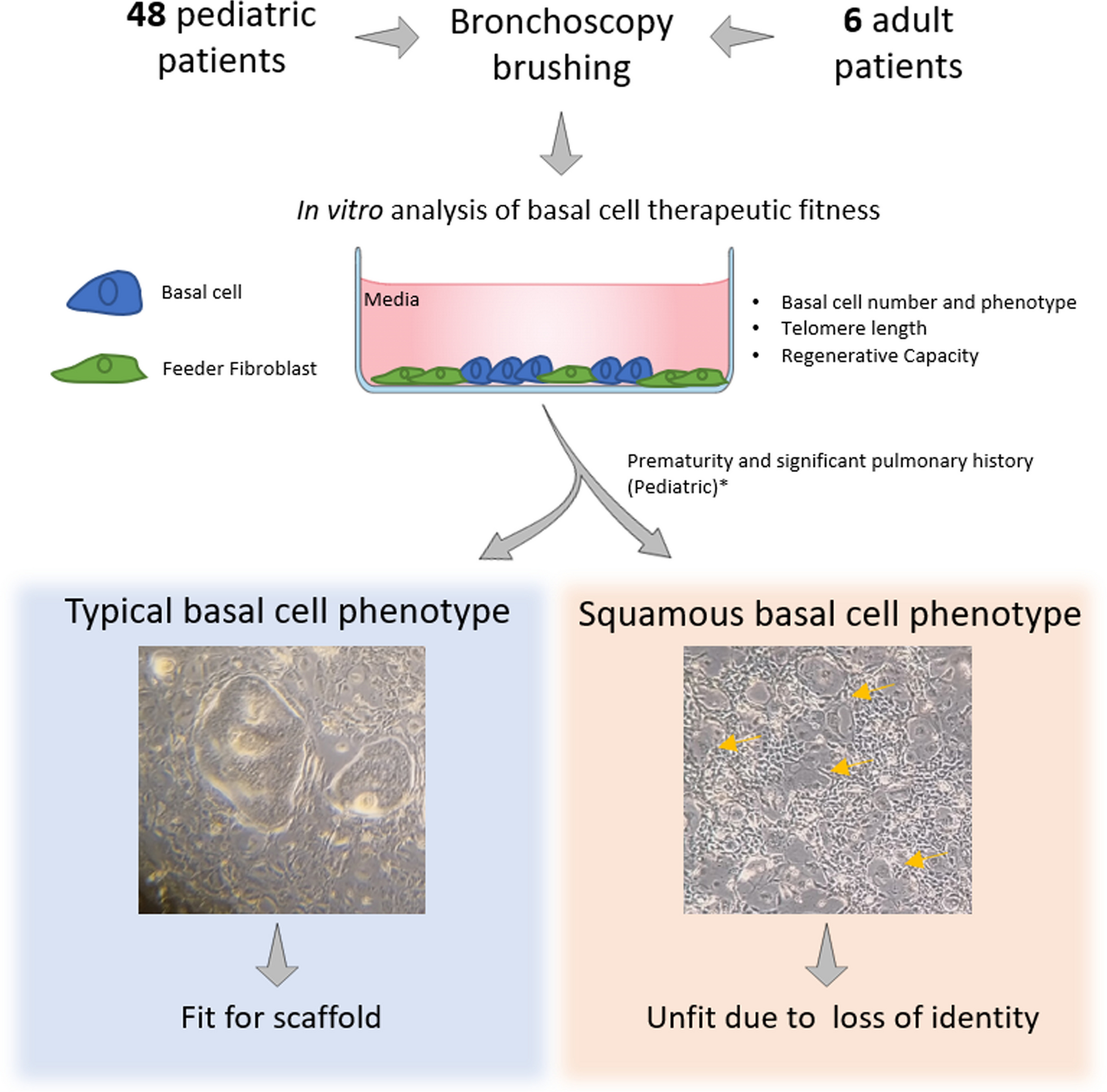 Airway disease decreases the therapeutic potential of epithelial stem cells