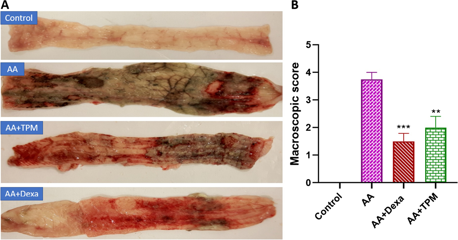 Protective effects of topiramate on acetic acid-induced colitis in rats through the inhibition of oxidative stress