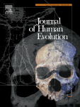 Sex-biased sampling may influence Homo naledi tooth size variation