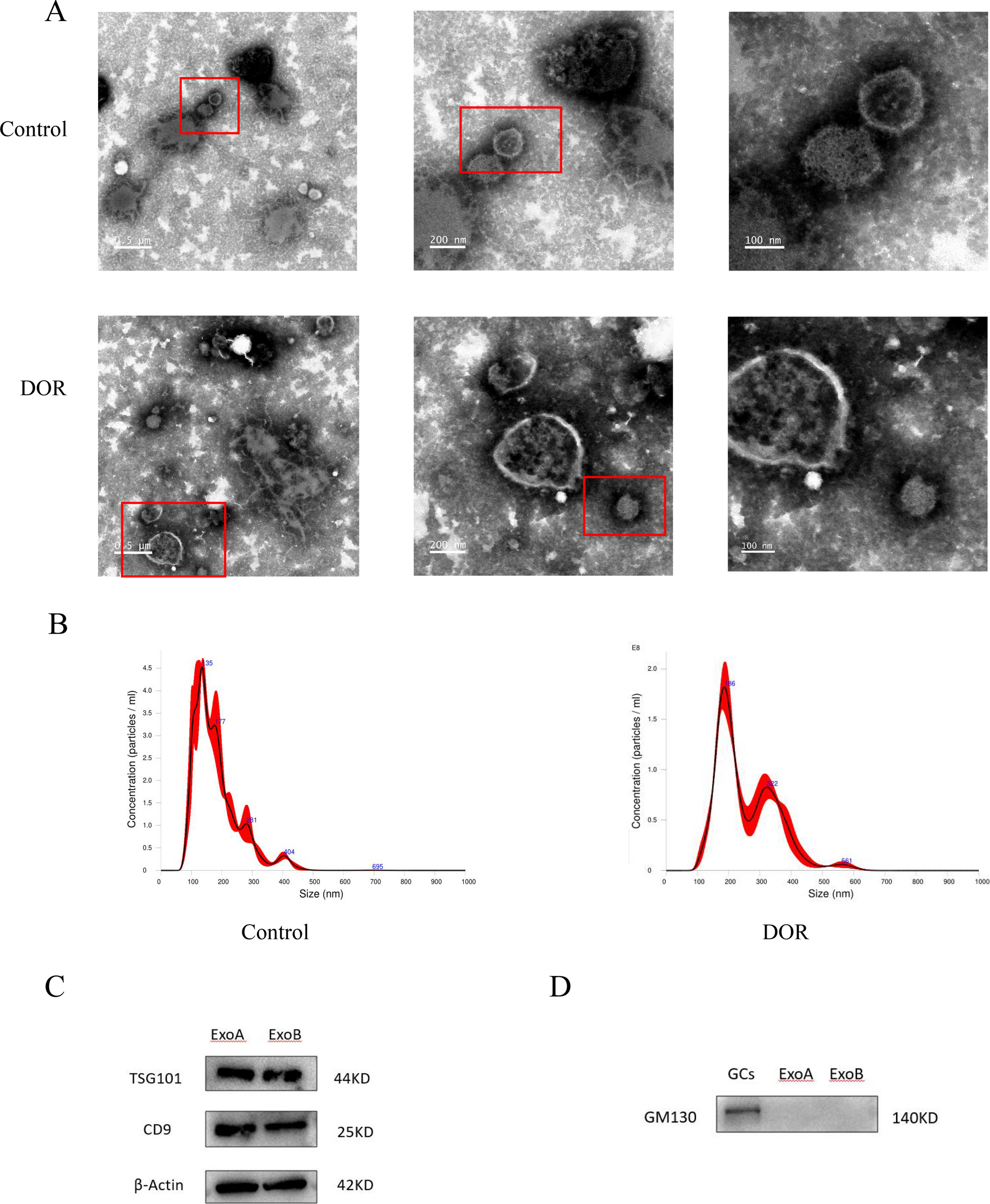 Differential expression of follicular fluid exosomal microRNA in women with diminished ovarian reserve