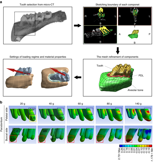 The osteoclastic activity in apical distal region of molar mesial roots affects orthodontic tooth movement and root resorption in rats