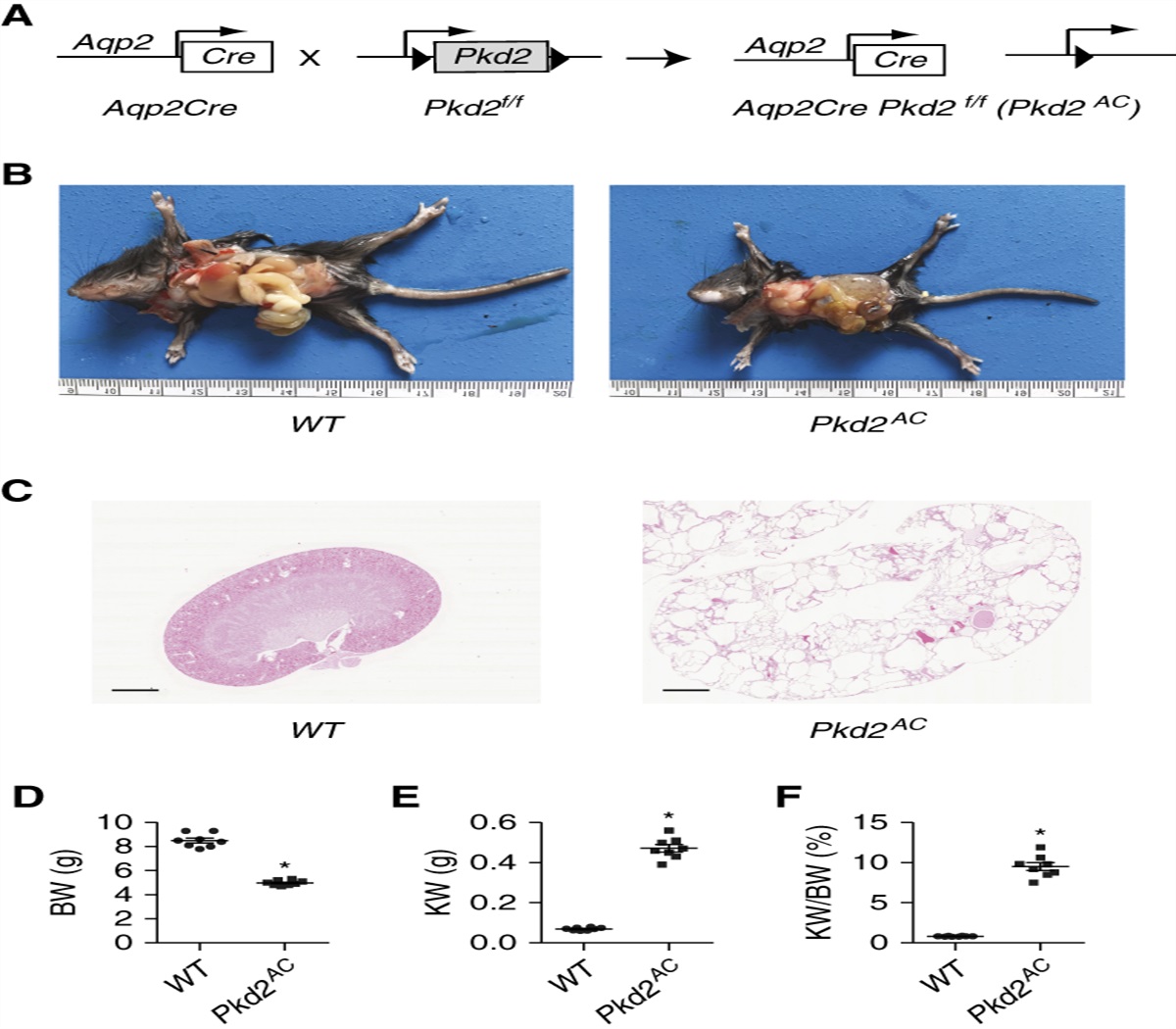 Pkd2 Deficiency in Embryonic Aqp2+ Progenitor Cells Is Sufficient to Cause Severe Polycystic Kidney Disease