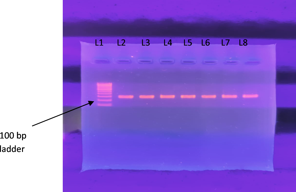 The First-Ever Investigation of SNP rs119461977 in SECISBP2/SBP2 Gene and its Implications for Hypothyroidism: A Novel Case–Control Research