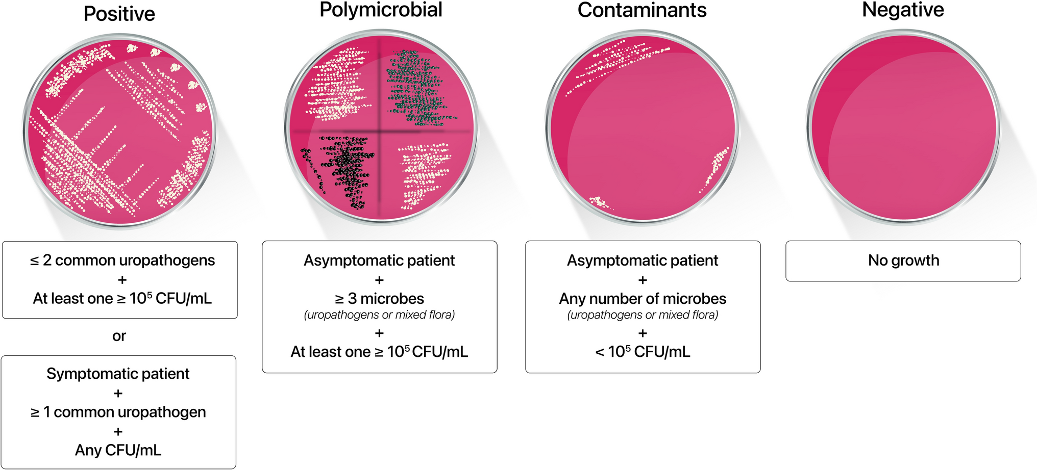 Preoperative urine culture with contaminants is not associated with increased risk for urinary tract infection after ureteroscopic stone treatment