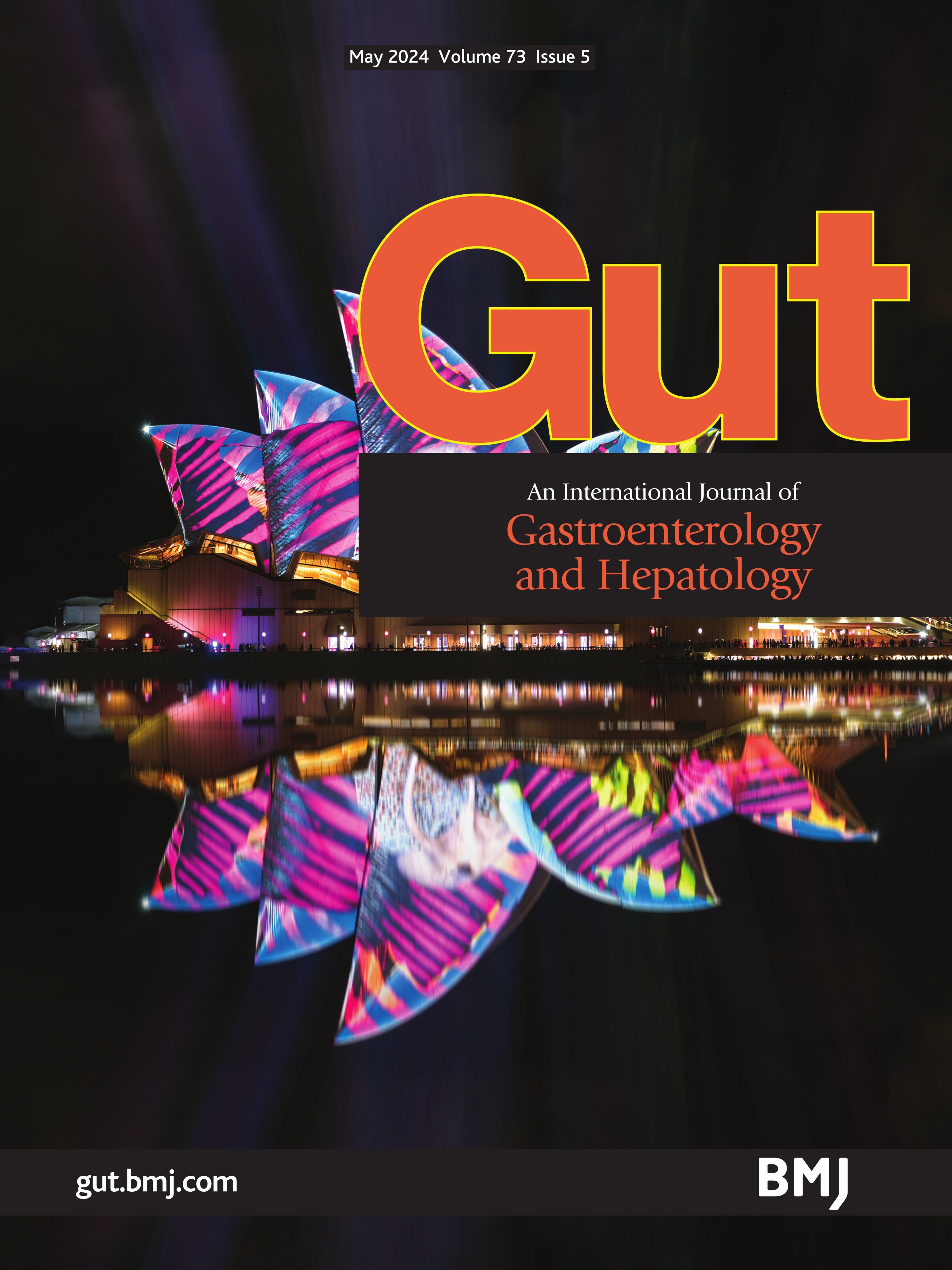 Serum ferritin levels can predict long-term outcomes in patients with metabolic dysfunction-associated steatotic liver disease