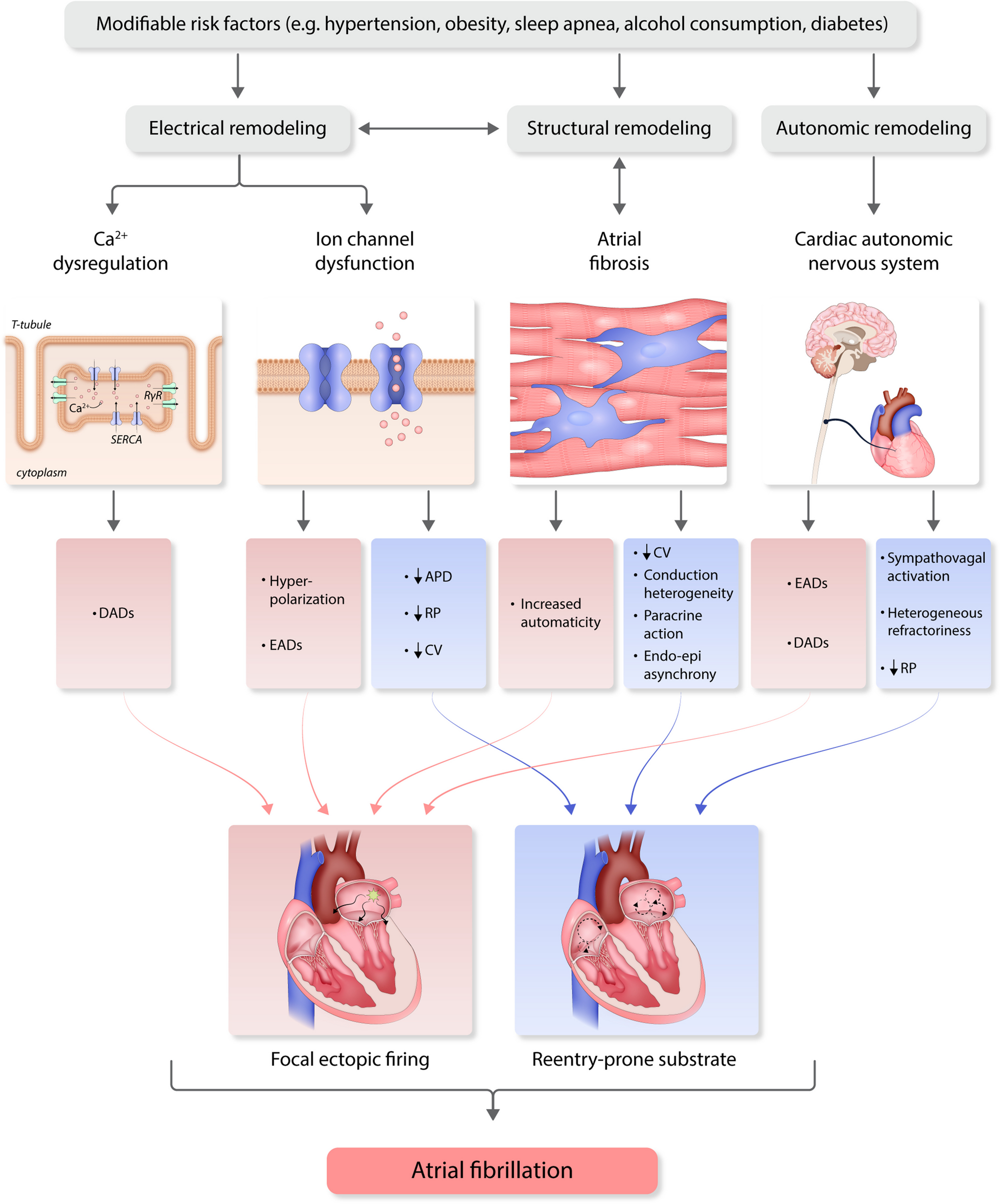 2024 European Heart Rhythm Association/Heart Rhythm Society/Asia Pacific Heart Rhythm Society/Latin American Heart Rhythm Society expert consensus statement on catheter and surgical ablation of atrial fibrillation