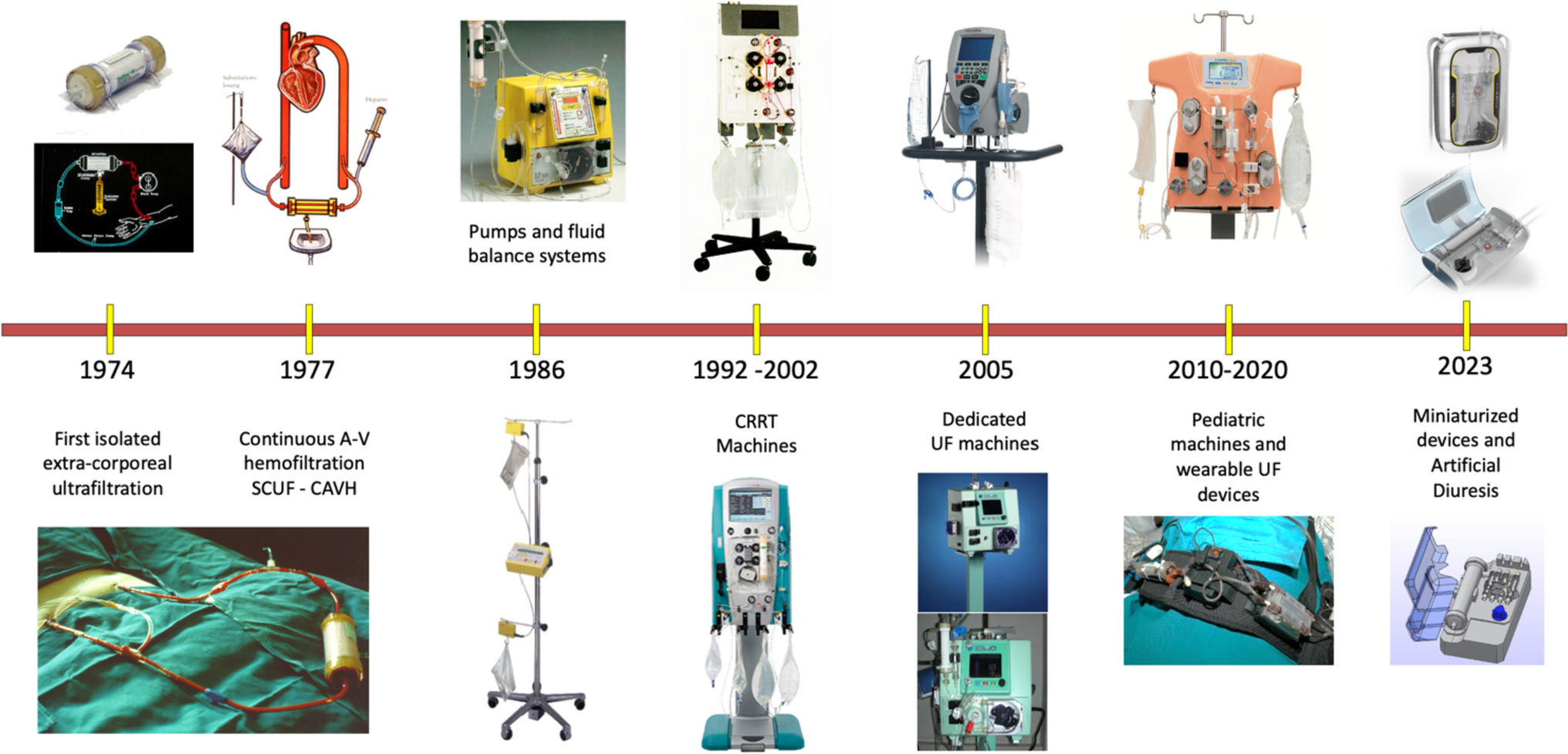 Development of a new miniaturized system for ultrafiltration