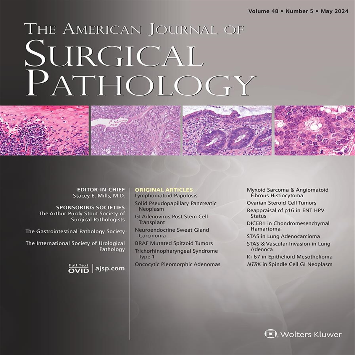 Correspondence: SPARC, HEG1, and the Diagnosis of Epithelioid Mesothelioma