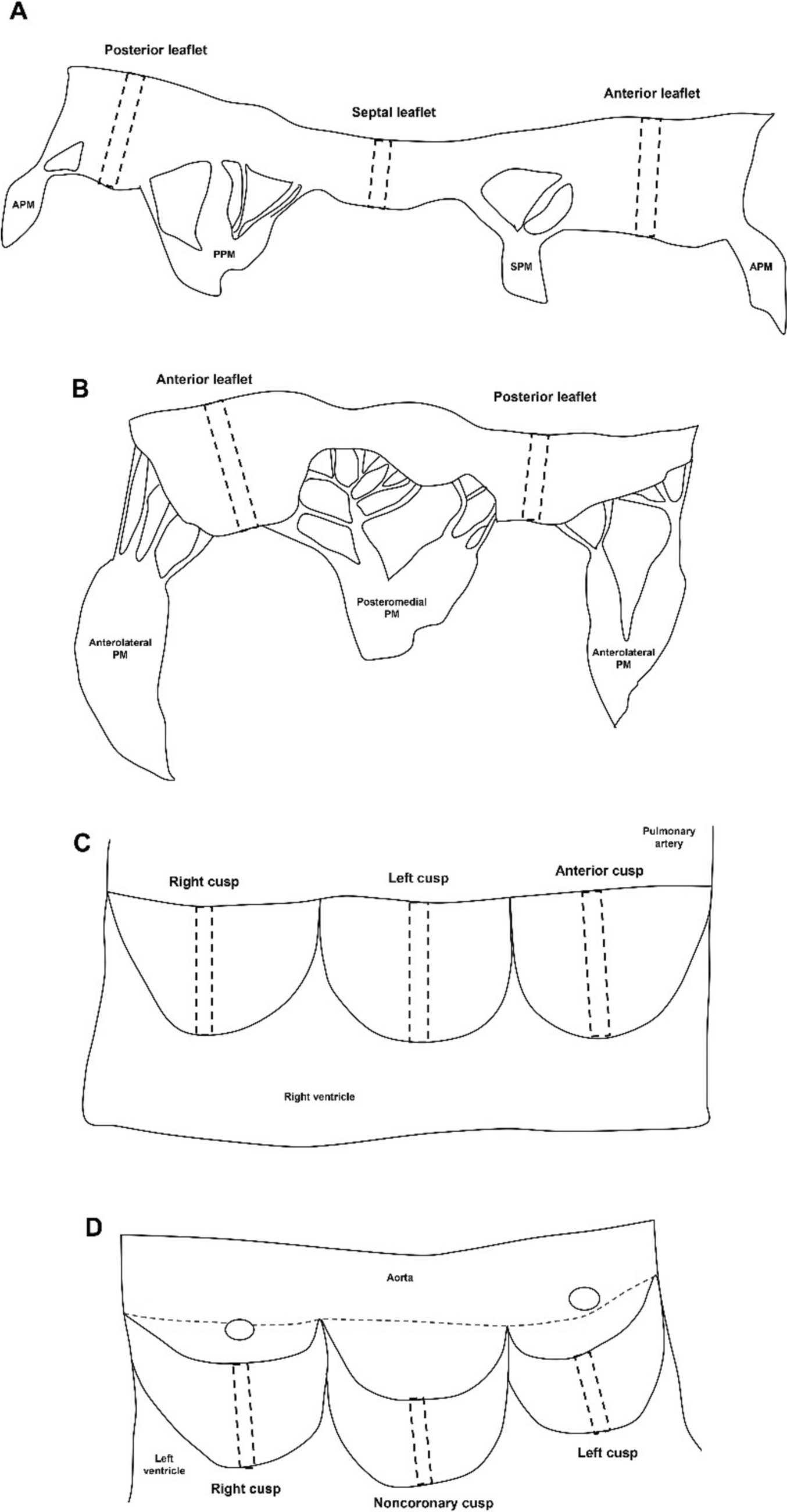 Collagen and elastic fibers assessment of the human heart valves for age estimation in Thais using image analysis