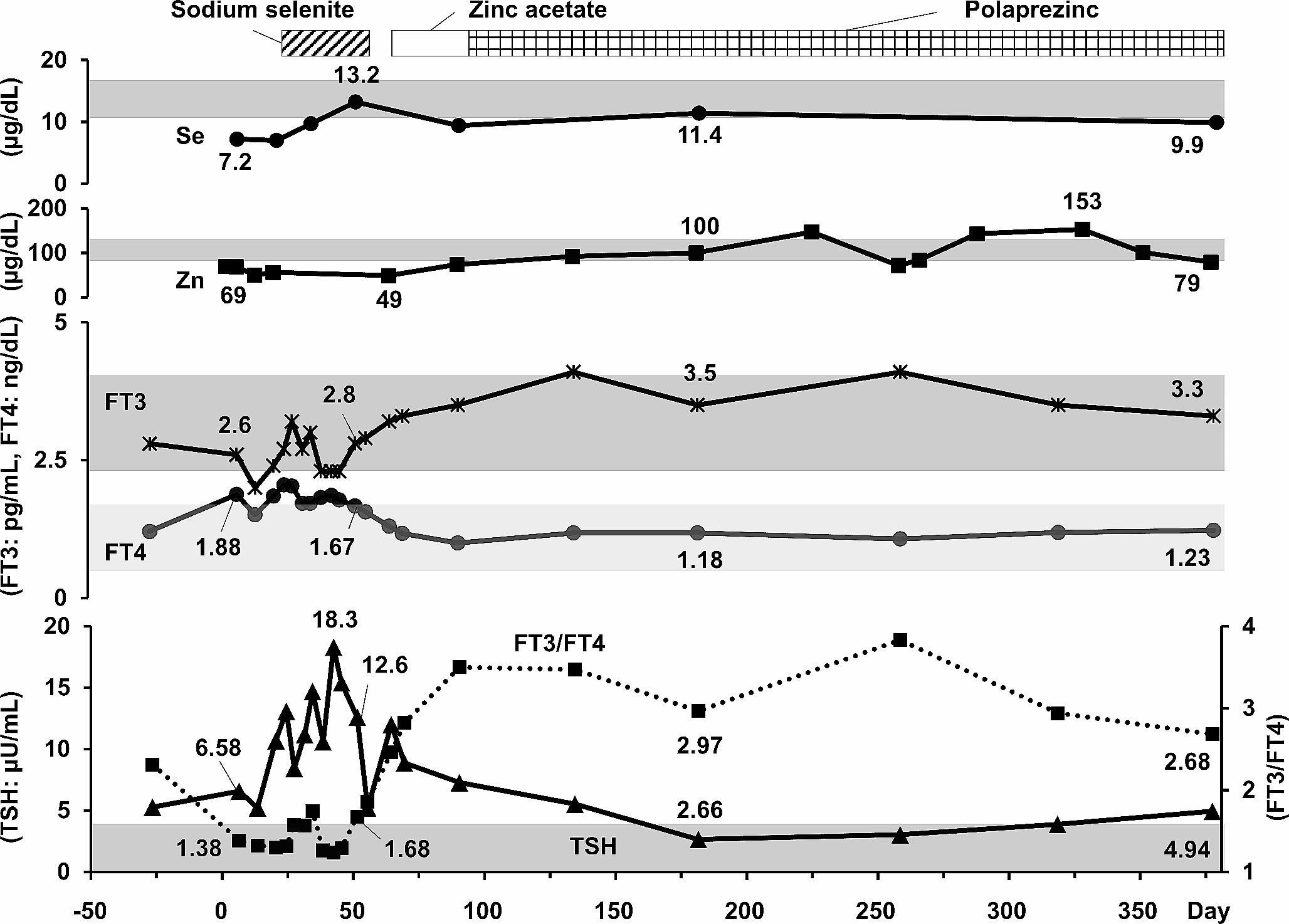 Thyroid dysfunction due to trace element deficiency—not only selenium but also zinc