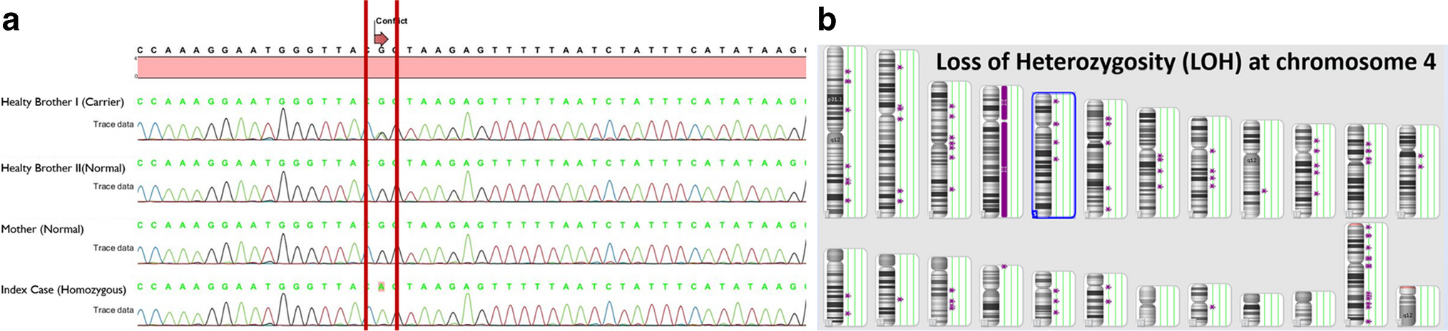 Primary immune regulatory disorders (PIRD): expanding the mutation spectrum in Turkey and identification of sixteen novel variants