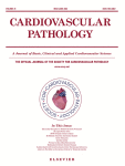 Frequent protein kinase A regulatory subunit A1 mutations but no GNAS mutations as potential driver in sporadic cardiac myxomas