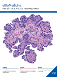 Human antibody signatures towards the Chlamydia trachomatis major outer membrane protein after natural infection and vaccination