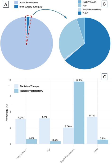 Benign prostatic hyperplasia during active surveillance for prostate cancer: is it time to define management strategies?