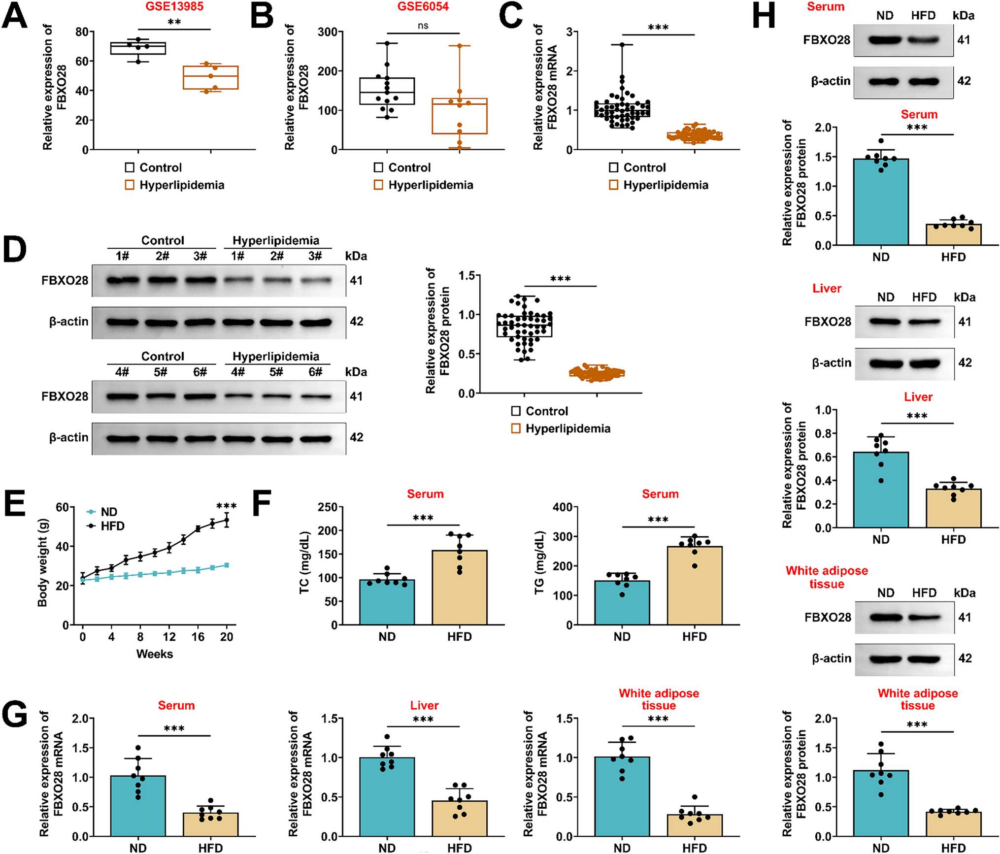 FBXO28 reduces high-fat diet-induced hyperlipidemia in mice by alleviating abnormal lipid metabolism and inflammatory responses