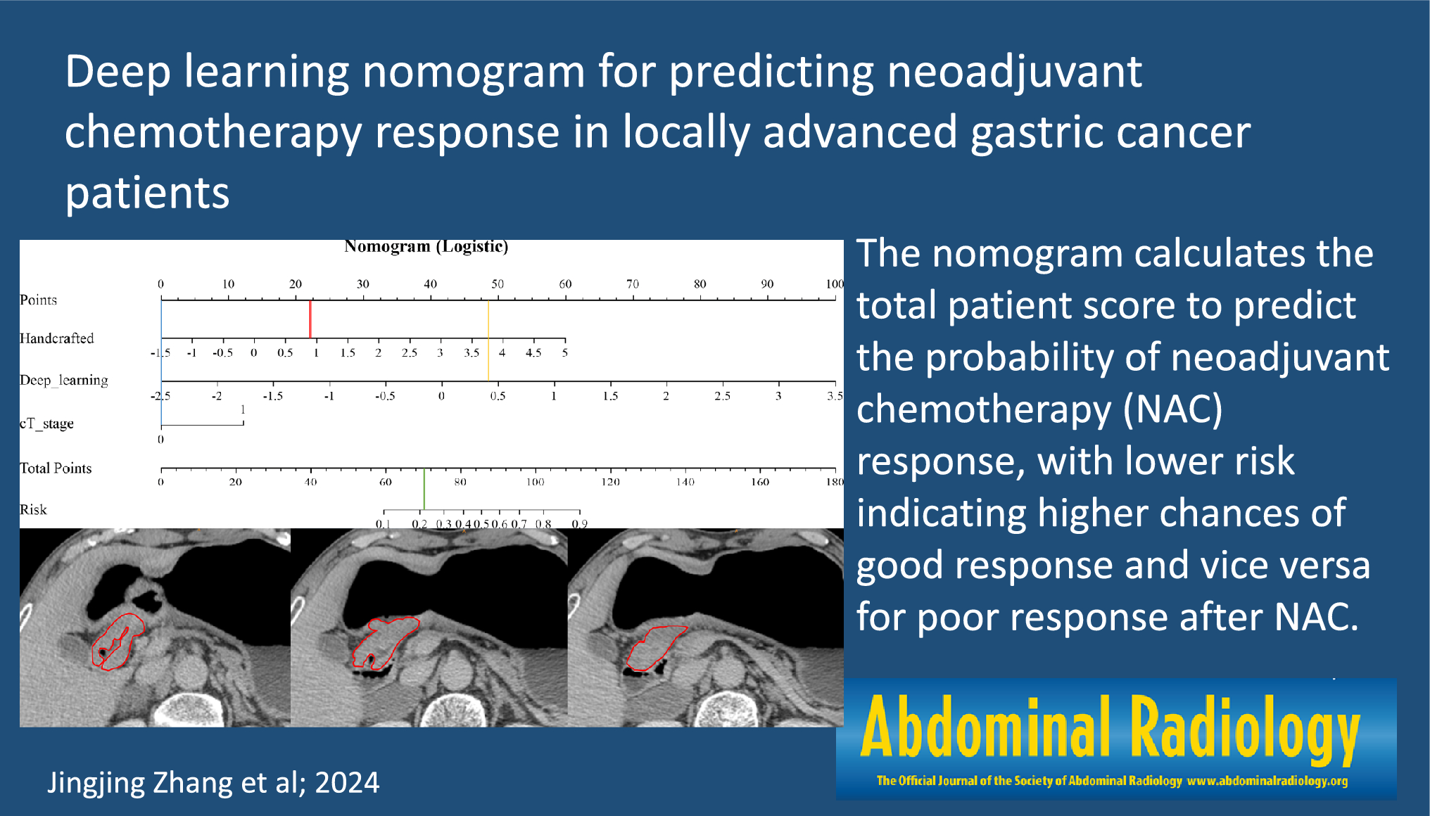 Deep learning nomogram for predicting neoadjuvant chemotherapy response in locally advanced gastric cancer patients