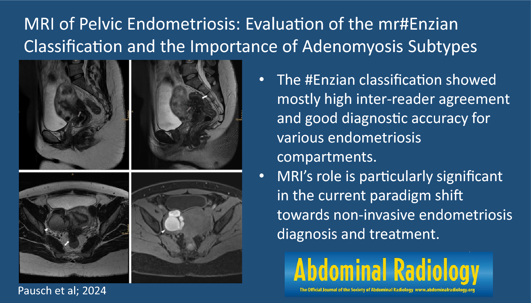 MRI of pelvic endometriosis: evaluation of the mr#Enzian classification and the importance of adenomyosis subtypes