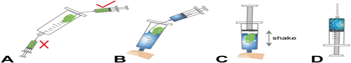 Enhancing Inverted Internal Limiting Membrane Flap Stability in Macular Hole Retinal Detachment by the “Viscoelastic Agent Pool” Technique