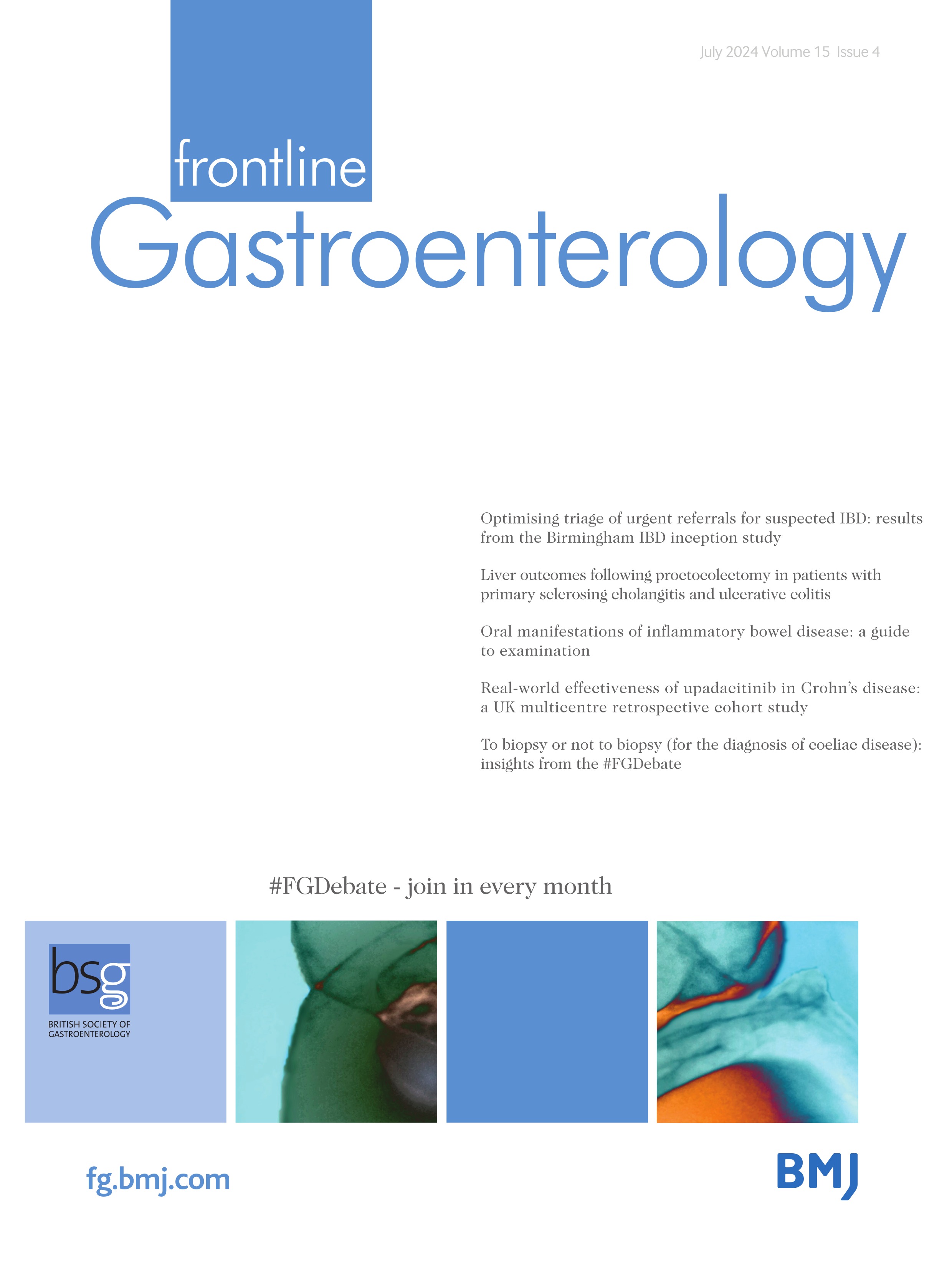 Randomised trial of 'hybrid water-assisted colonoscopy (modified water immersion) versus water exchange colonoscopy: WAVE study