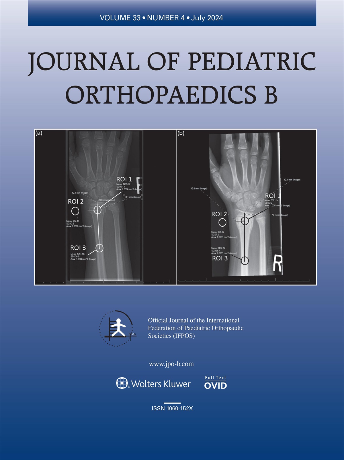 Results of two techniques of lateral closing wedge osteotomy for cubitus varus: comment on the study by Masquijo et al.