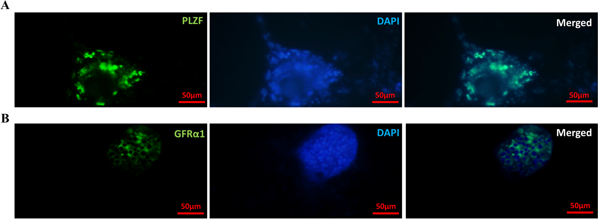 The effect of epididymosomes on the development of frozen-thawed mouse spermatogonial stem cells after culture in a decellularized testicular scaffold and transplantation into azoospermic mice