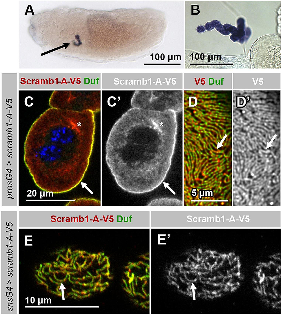 Phospholipid scramblase 1: an essential component of the nephrocyte slit diaphragm