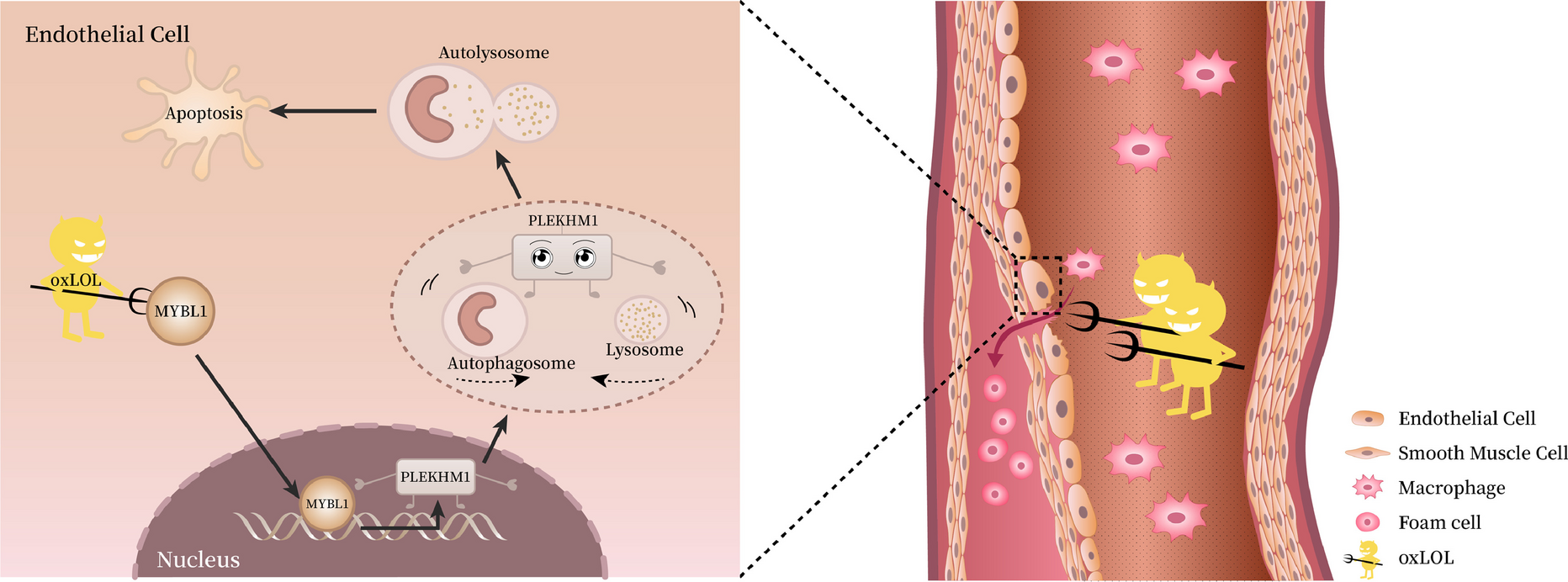 Downregulation of MYBL1 in endothelial cells contributes to atherosclerosis by repressing PLEKHM1-inducing autophagy