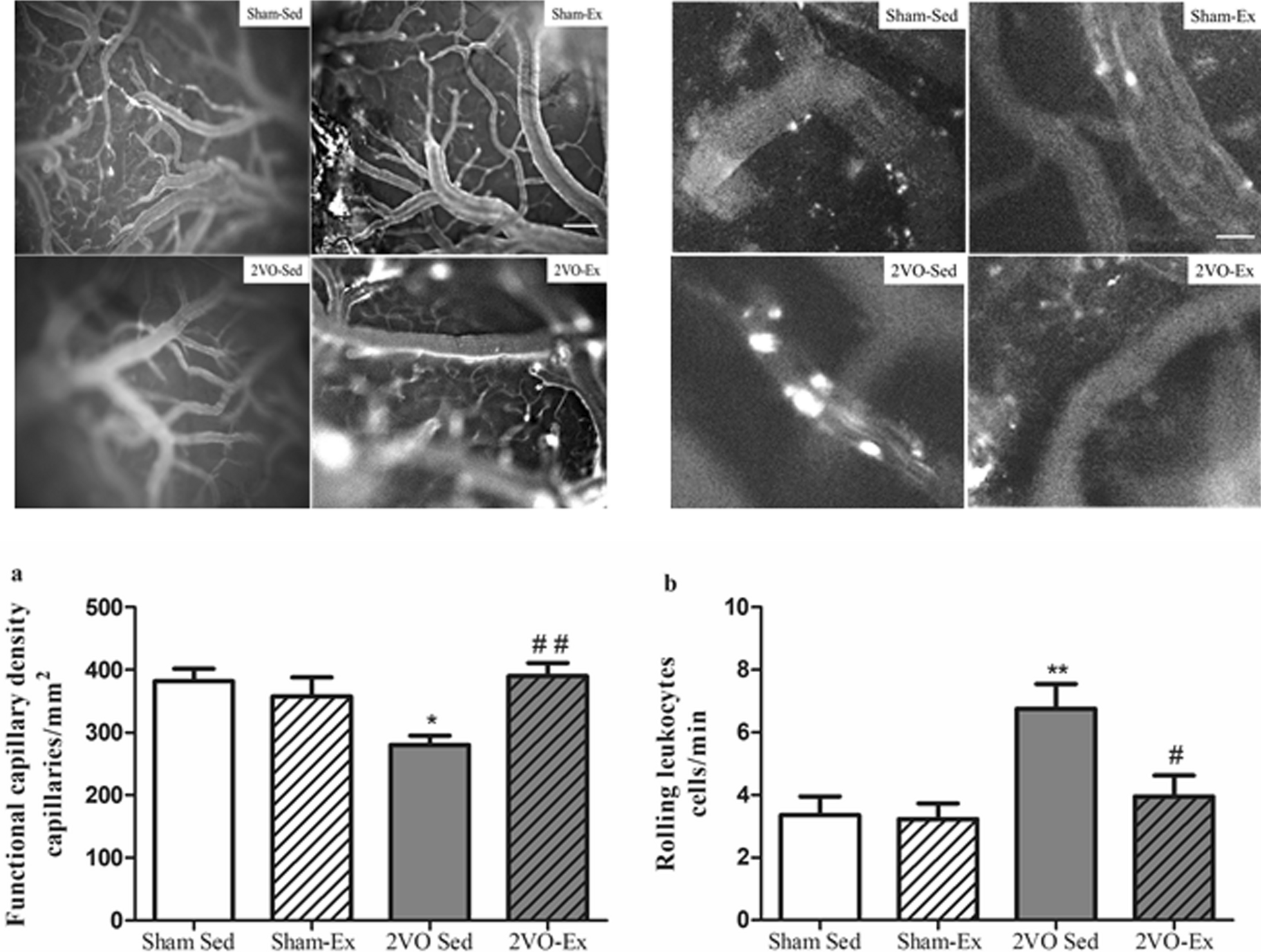 Correction: Physical exercise promotes astrocyte coverage of microvessels in a model of chronic cerebral hypoperfusion