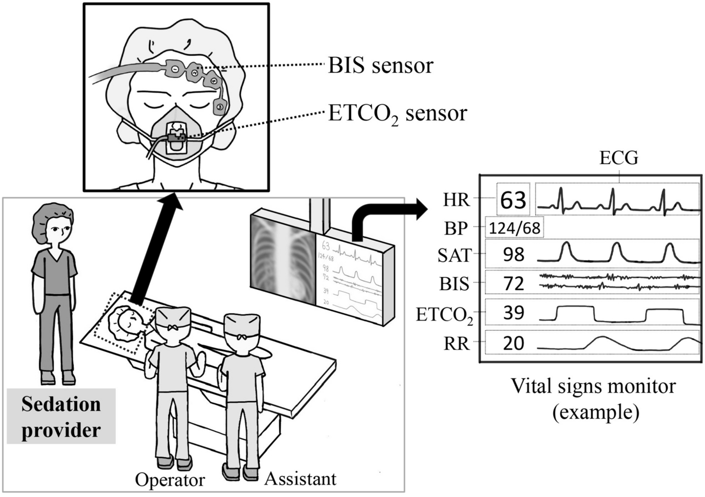 Safety of propofol sedation administered by interventional radiologists for radiofrequency ablation in patients with hepatocellular carcinoma