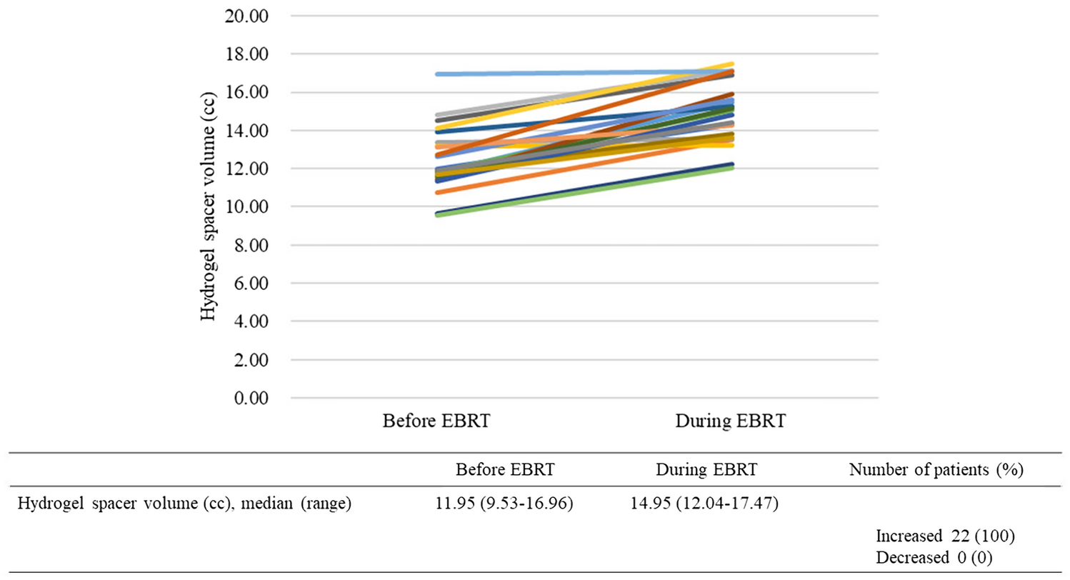 Unexpected change in hydrogel spacer volume during external-beam radiation therapy