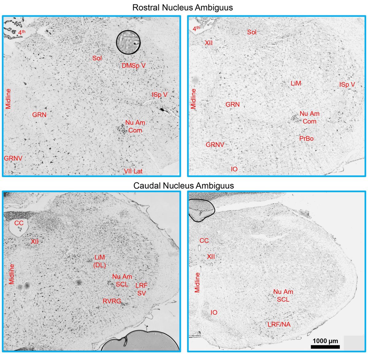 Dendritic morphology of motor neurons and interneurons within the compact, semicompact, and loose formations of the rat nucleus ambiguus