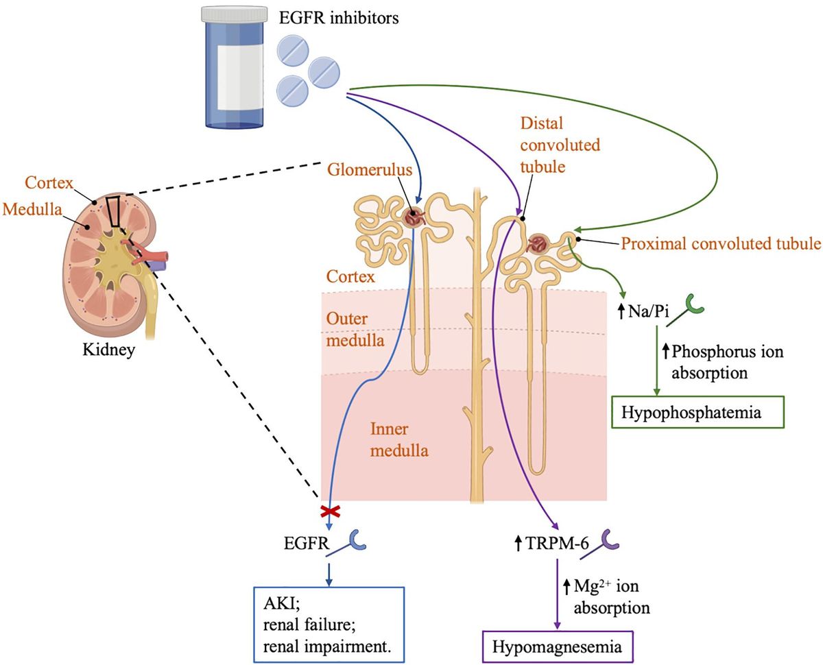 Nephrotoxicity of targeted therapy used to treat lung cancer