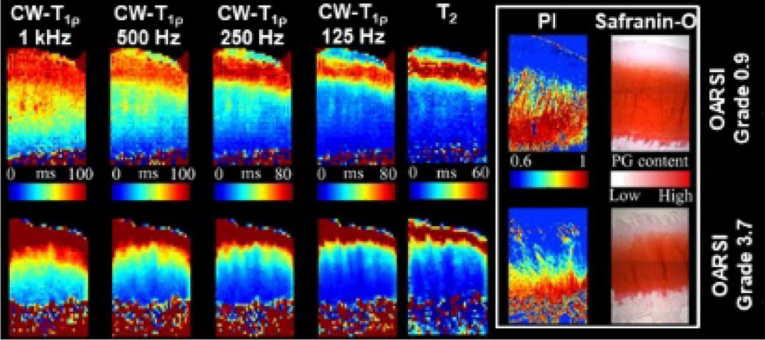 Quantitative MRI methods for the assessment of structure, composition, and function of musculoskeletal tissues in basic research and preclinical applications