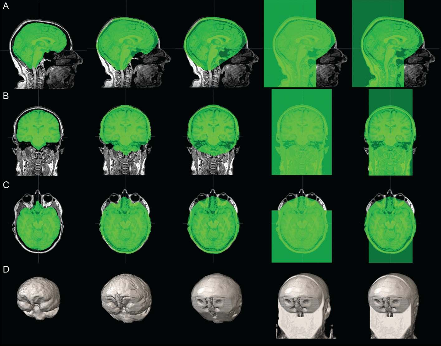 PyFaceWipe: a new defacing tool for almost any MRI contrast