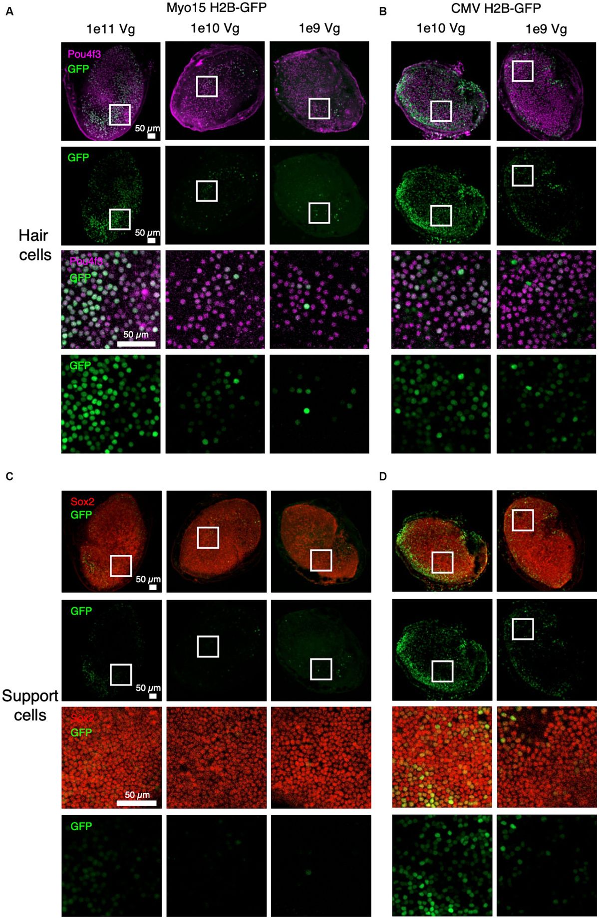 Recovery kinetics of dual AAV-mediated human otoferlin expression