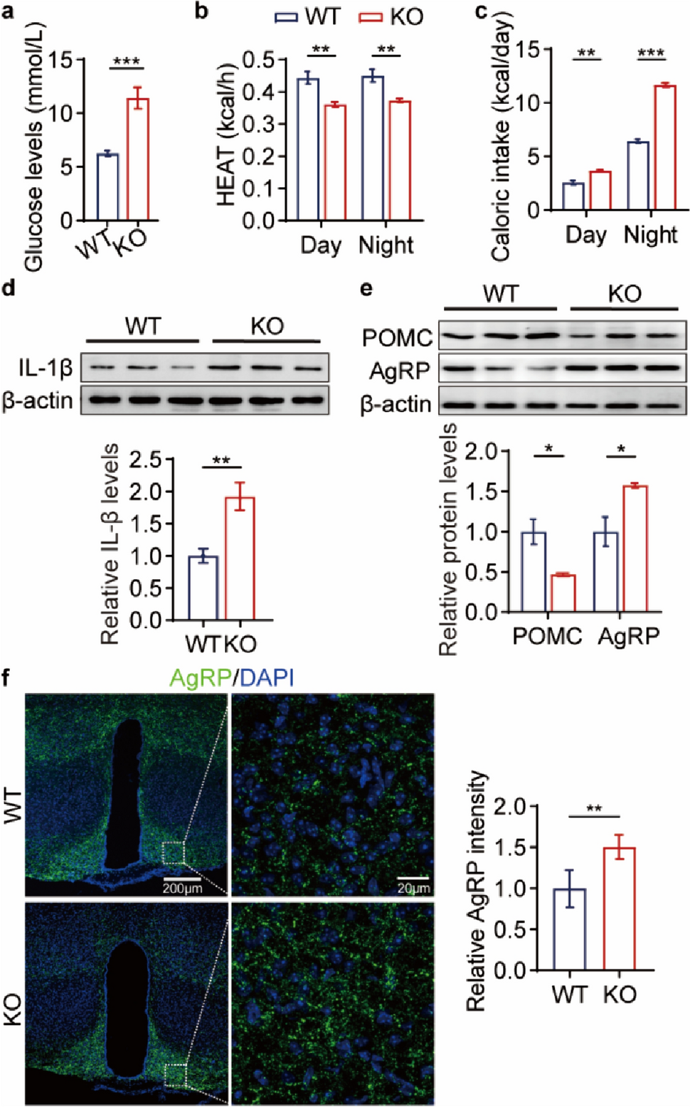 Seipin Deficiency Leads to Energy Dyshomeostasis via Inducing Hypothalamic Neuroinflammation and Aberrant Expression of Neuropeptides