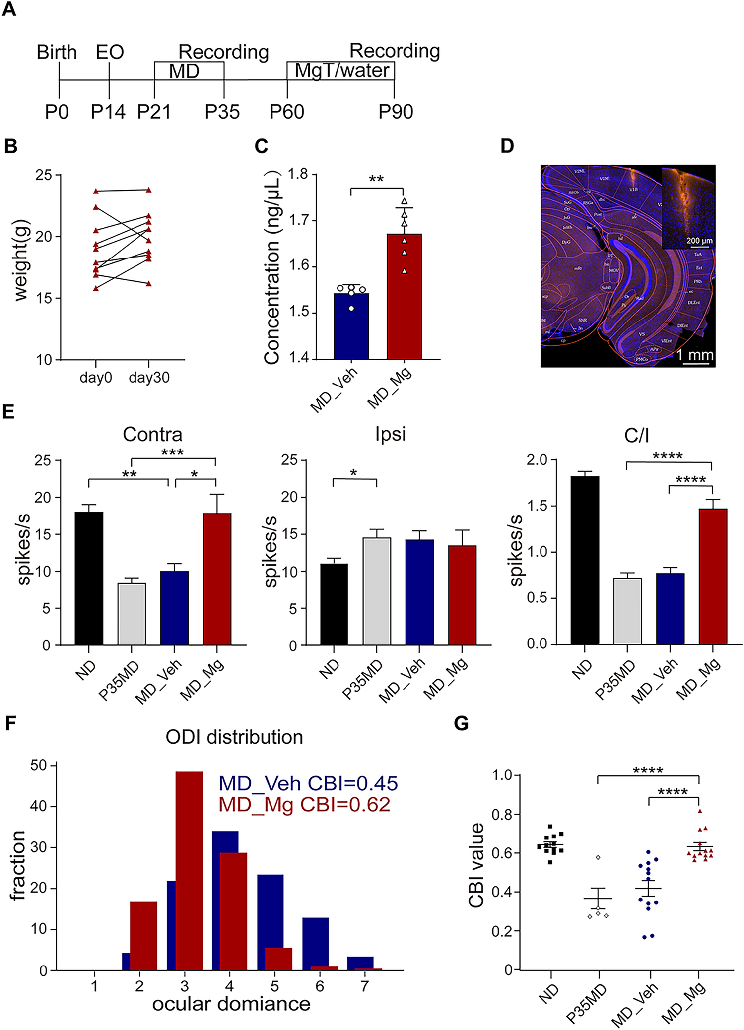 High Magnesium Promotes the Recovery of Binocular Vision from Amblyopia via TRPM7