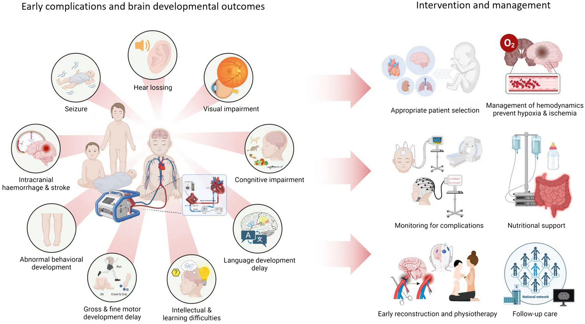 Brain development in newborns and infants after ECMO