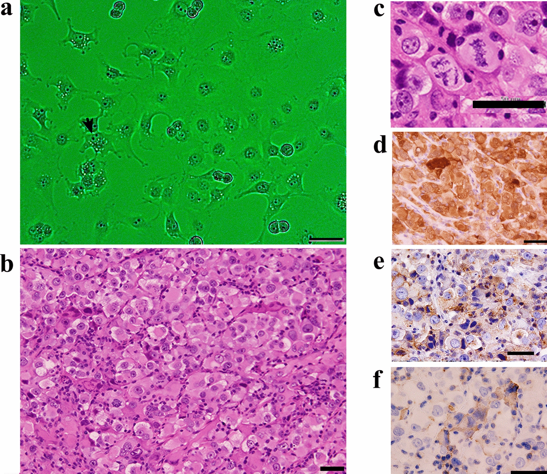 A xenotransplantable malignant deciduoid mesothelioma-cell line, D-Meso-Sonobe