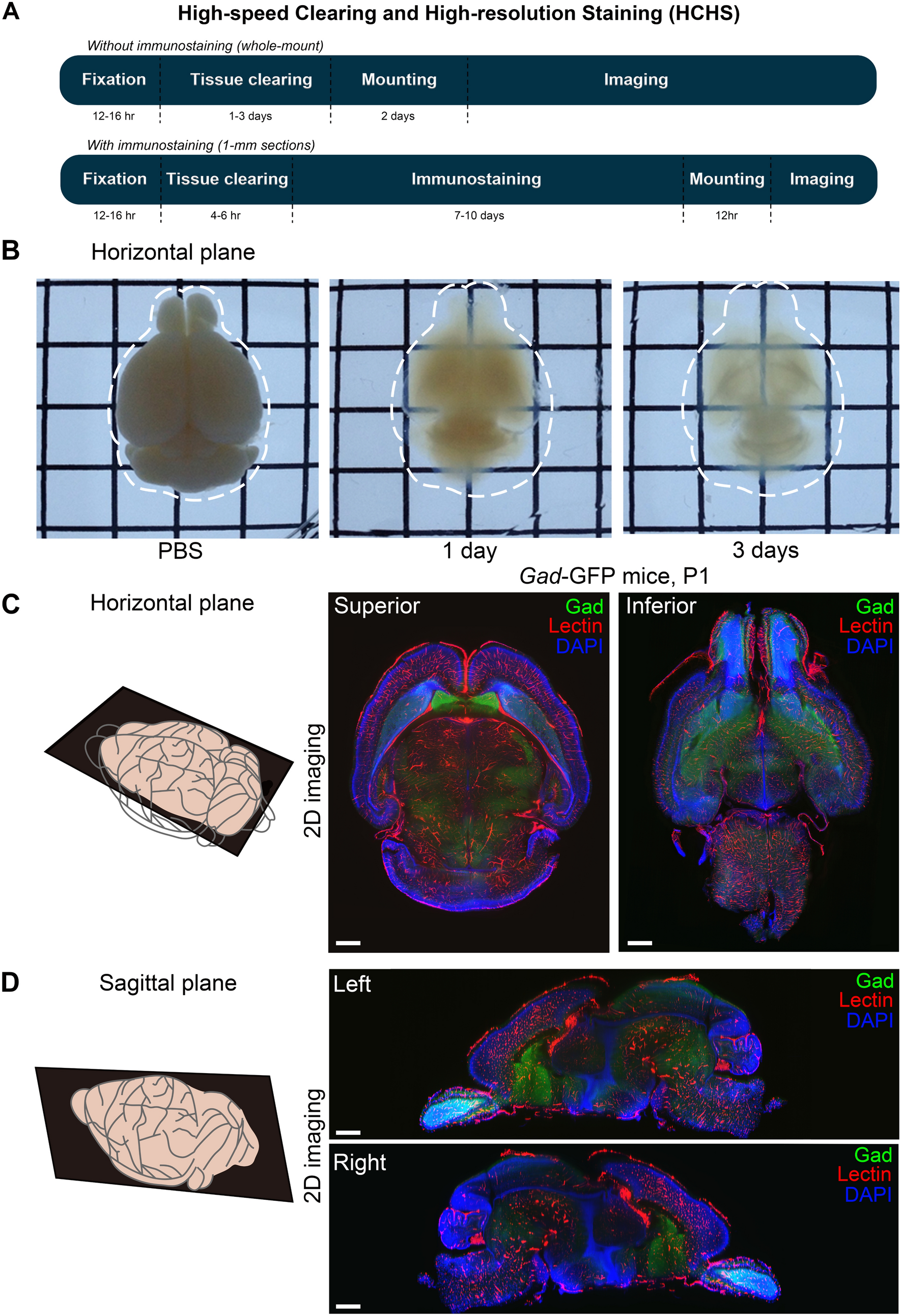 High-Speed Clearing and High-Resolution Staining for Analysis of Various Markers for Neurons and Vessels