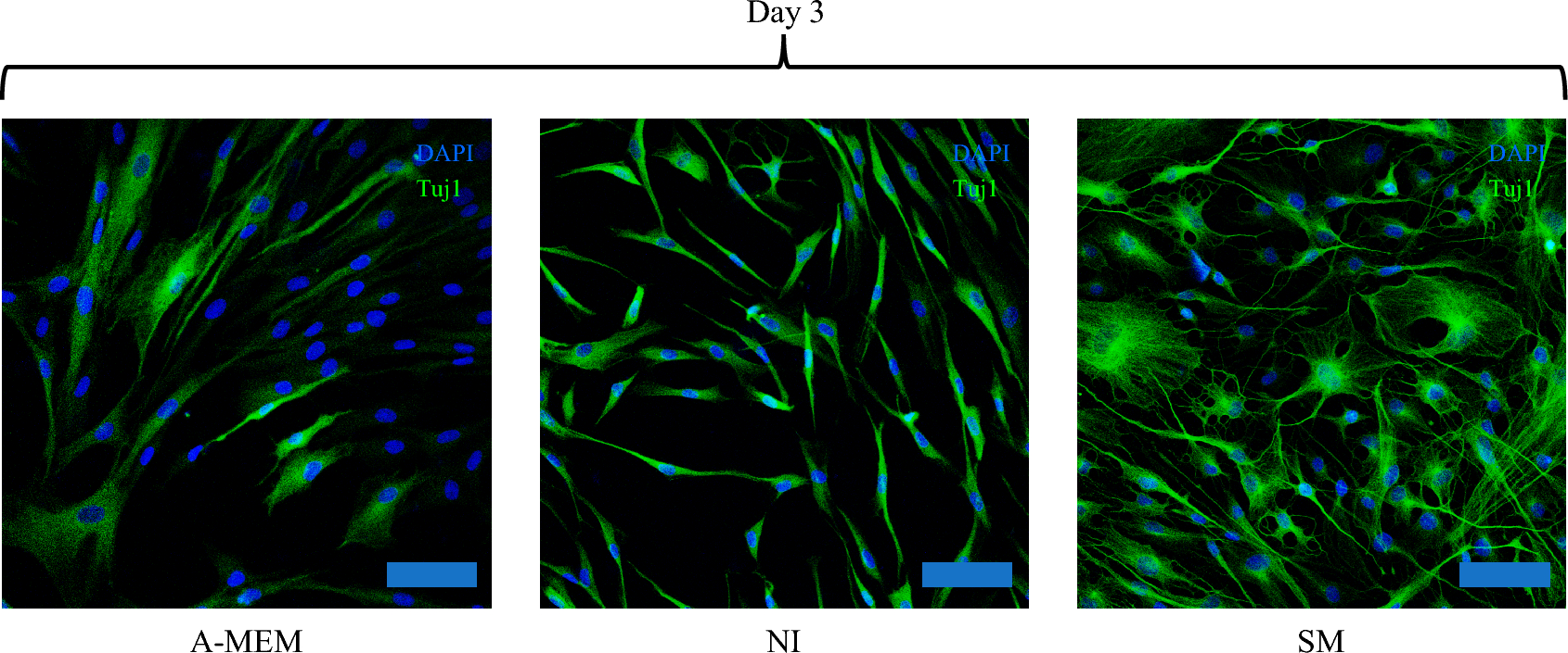 Transplantation of Neural Progenitor Cells Derived from Stem Cells from Apical Papilla Through Small-Molecule Induction in a Rat Model of Sciatic Nerve Injury