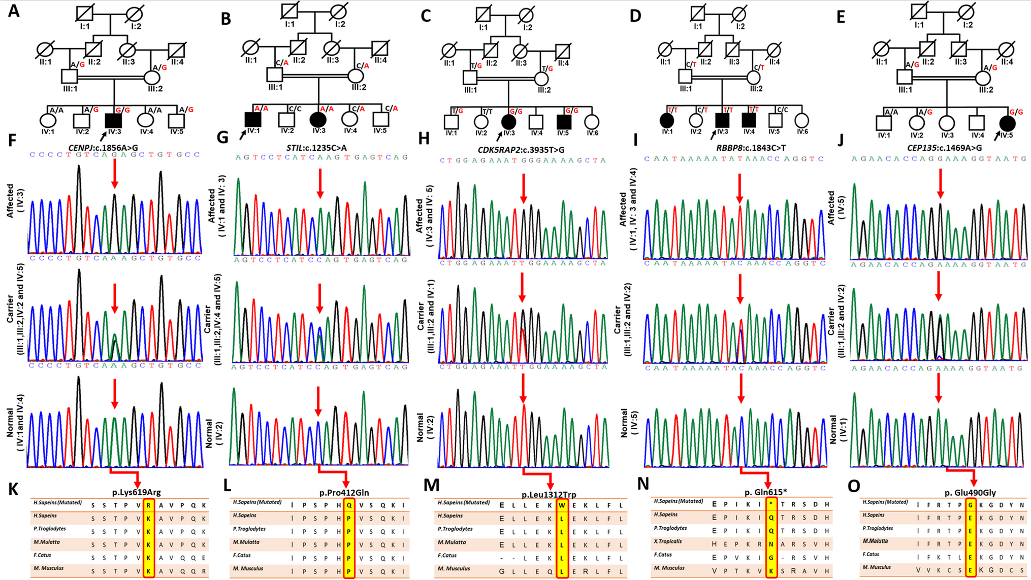 Clinical genomics expands the link between erroneous cell division, primary microcephaly and intellectual disability