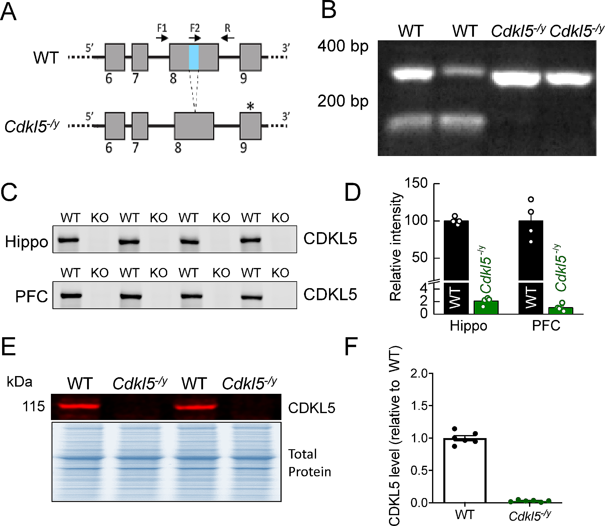 Enhanced hippocampal LTP but normal NMDA receptor and AMPA receptor function in a rat model of CDKL5 deficiency disorder