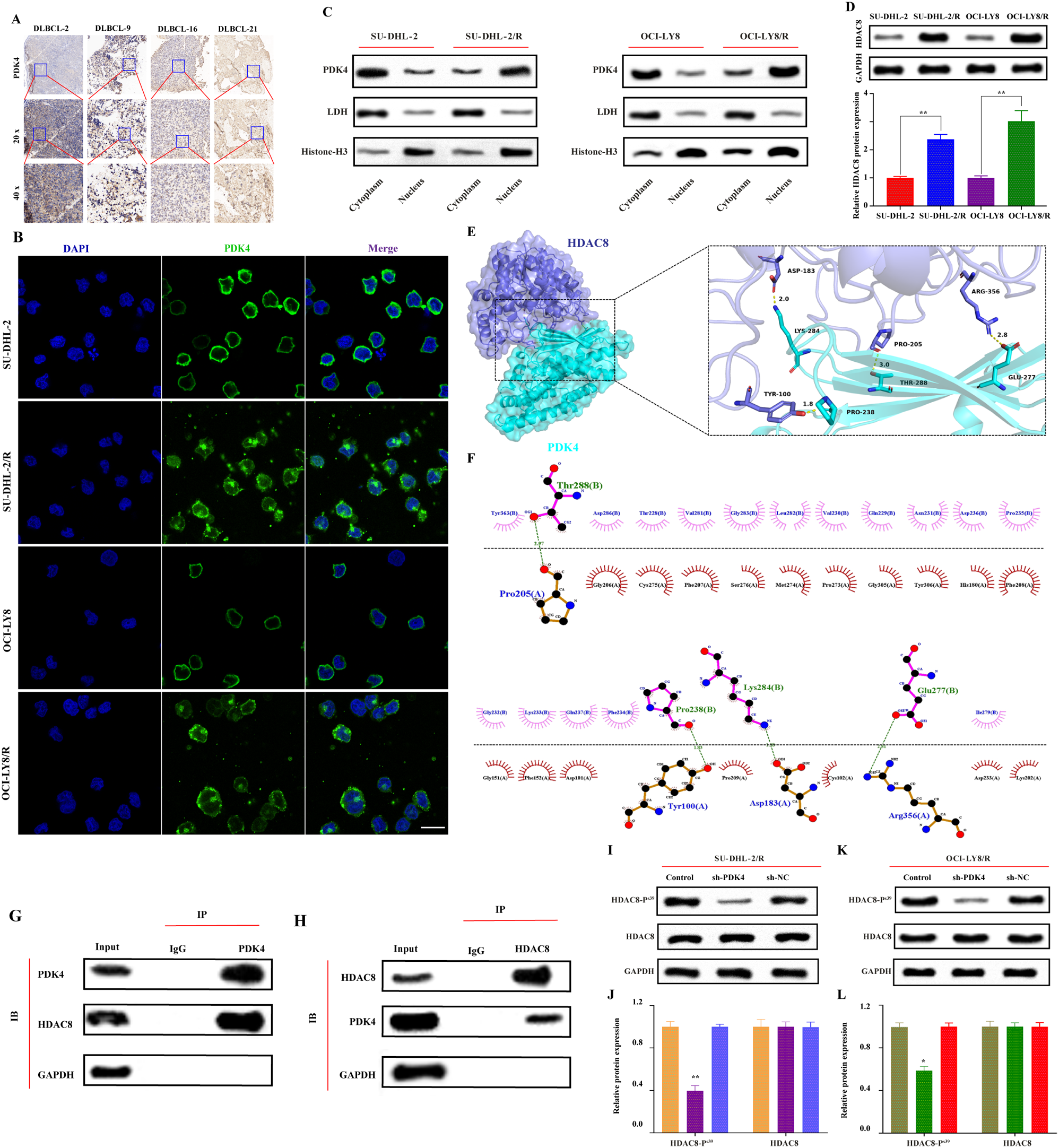 Unveiling the PDK4-centered rituximab-resistant mechanism in DLBCL: the potential of the “Smart” exosome nanoparticle therapy