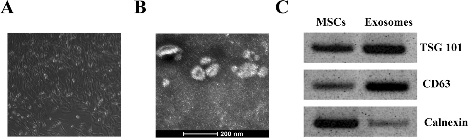 Bone marrow mesenchymal stem cells-derived exosomal miR-145-5p reduced non-small cell lung cancer cell progression by targeting SOX9