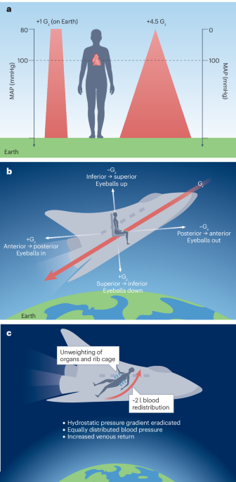 Computational modelling of cardiovascular pathophysiology to risk stratify commercial spaceflight