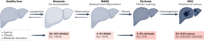 A roadmap for clinical trials in MASH-related compensated cirrhosis