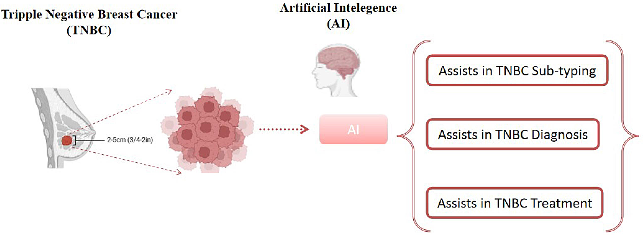 Advancements in triple-negative breast cancer sub-typing, diagnosis and treatment with assistance of artificial intelligence : a focused review